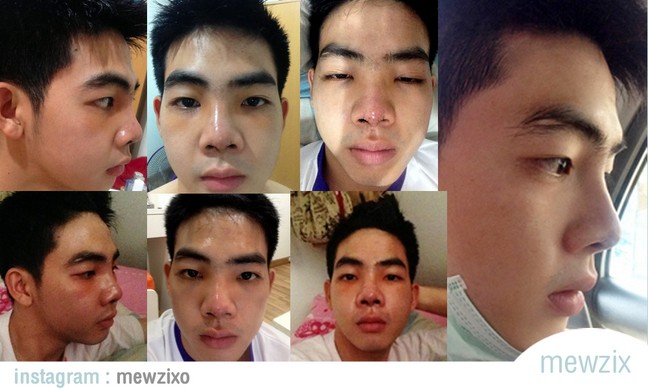 ศัลยกรรม